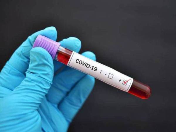 Bila demam, ramai keliru terkena virus Covid-19 atau denggi, pakar dari dalam dan luar negara beri penjelasan...