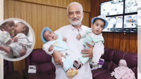 Bayi kembar siam Pakistan berjaya dipisahkan. Ada dermawan berhati mulia biayai kos pembedahan...