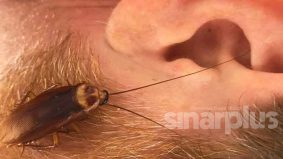 Jangan panik jika serangga masuk telinga, guna cara ini
