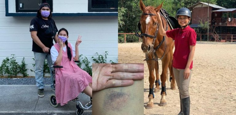 Tragedi jatuh kuda, Sissy Imann perlu berehat sebulan