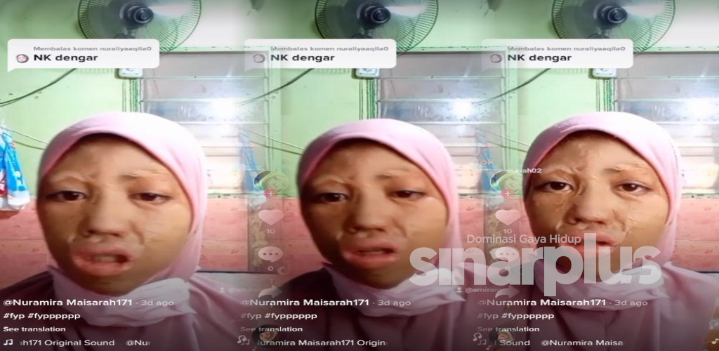[VIDEO] Gara-gara tertarik tong gas di dapur, gadis ini kongsi pengalaman dibungkus seperti mumia