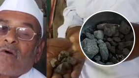 Gara-gara selalu sakit perut, lelaki ini makan batu lebih 30 tahun sebagai ‘penawar’