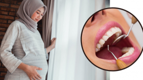 Mulut berasid, air liur kering punca gigi ibu hamil mudah rosak. Ini cara terbaik untuk atasinya