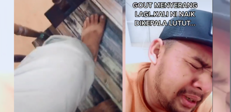 [VIDEO] Menangis ketika naik tangga, lelaki ini kongsi tahan azab hadap gout menyerang kepala lutut