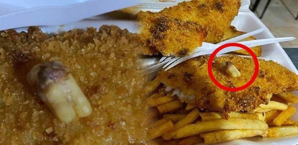 Jijik! Wanita menemui gigi manusia dalam hidangan fish and chips