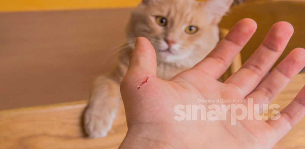 Cat Scratch Fever mampu membawa maut! Pencinta kucing, ini apa korang perlu tahu