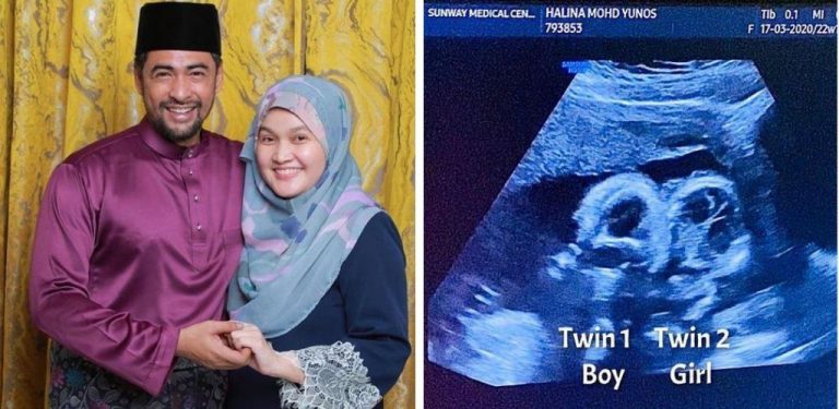 'Twin 1 is a boy and twin 2 is a girl. Allahuakbar'. Dr Sheikh Muszaphar, Dr Halina dapat kembar lagi