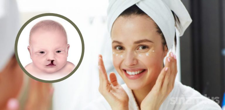 Bayi sumbing: Waspada kandungan bahan dalam produk skincare