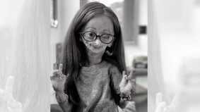 Hidap penyakit ‘rare’ progeria, 1 dalam 4 juta, YouTuber Adalia Rose meninggal dunia pada usia 15 tahun