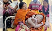 Bayi empat tangan, empat kaki jadi 'selebriti' sekelip mata, kes luar biasa di India didakwa jelmaan dewa