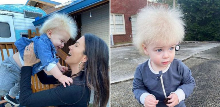 Kanak-kanak alami sindrom ‘rare’ rambut tidak boleh disikat, hanya dihidapi 100 orang di dunia