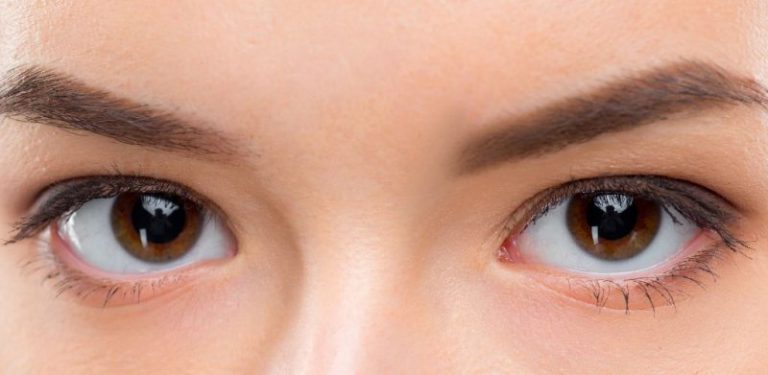 Kenali 5 keadaan mata yang perlu diberi perhatian. Kalau tak berhati-hati boleh terkena radang atau cincin putih